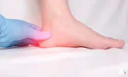 Eskişehir'de topuk dikenine lazer çözümü