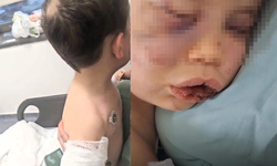 Aile ve Sosyal Hizmetler Bakanlığı: "Tedavi sürecinin ardından çocuğumuz devlet korumasına alınacaktır"