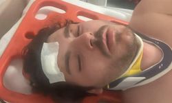 Darp edilen oyuncu dehşet anlarını anlattı: "Ölecektim"