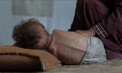 Gazze'de 2'si çocuk 5 kişi daha açlıktan hayatını kaybetti