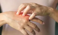Uzmanı uyardı: Geçmeyen morarma ve kanamalara dikkat!