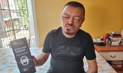 Saçlarını siyahlatmak için aldığı şampuan arı sokmasından beter hale getirdi