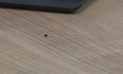 Ağrıyla kıvranan 2 yaşındaki çocuğun bağırsağından 3 santimlik iğne çıktı