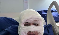 Akıl almaz olay: Genç kadın başka bir kadın tarafından ateşe verildi