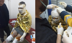 Kömür ocağında yangın: 2 işçi yaralı