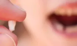 Rüyada diş düşmesi ne demek?