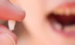 Rüyada diş dökülmesi görmek kötüye mi işaret?