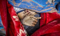 Lancet: Gazze’de can kaybı resmi verilerin çok üzerinde