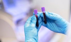 İşe alımlarda uyuşturucu testi dönemi: Talepler 6-7 kat arttı