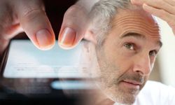 Telefon bağımlılığı erken yaşlandırıyor: Saç beyazlaması riski 7 kat artıyor