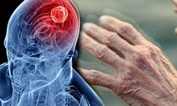 Uzmanı uyardı: "Parkinson hastalığında erken teşhis önemli"