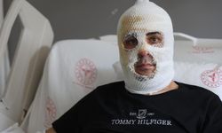 Ekmek teknesi küle dönmesin diye mücadele eden esnafın yüzü ve vücudu yaşanan patlamayla yandı