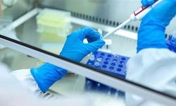 Rusya'dan veba laboratuvarı çalışanının ölümü sonrası açıklama