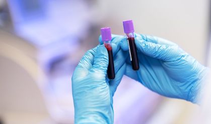 İşe alımlarda uyuşturucu testi dönemi: Talepler 6-7 kat arttı