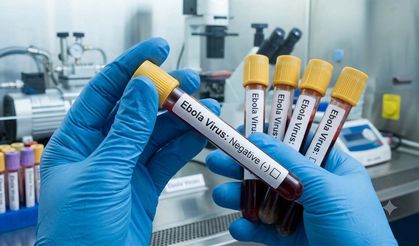 Kongo'da Ebola alarmı büyüyor: Vaka sayısı 1406'ya yükseldi