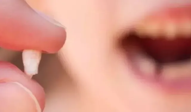 Rüyada diş düşmesi ne demek?