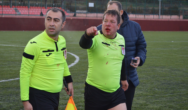 TFFHGD Eskişehir Şubesinden kınama geldi