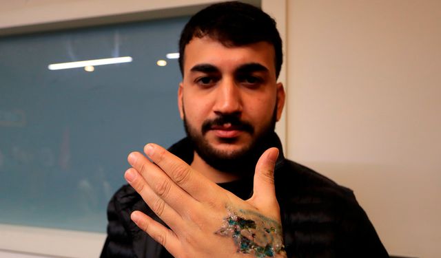 Dövme sildirmek isterken kabusu yaşadı, elindeki dokular öldü