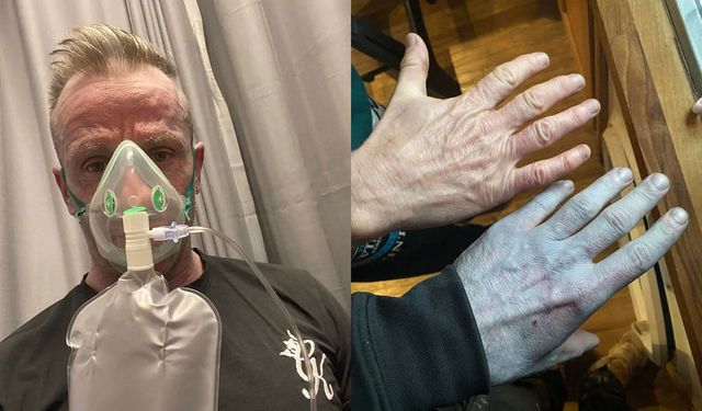 Sabah uyandığında vücudu tamamen maviye döndü! Doktorlar bile şakına döndü