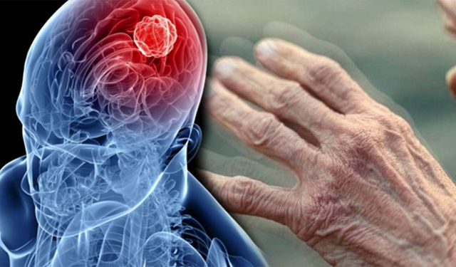 Uzmanı uyardı: "Parkinson hastalığında erken teşhis önemli"
