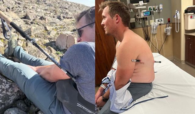 Vücuduna yürüyüş sopası saplanan dağcı 16 kilometre yürüdü