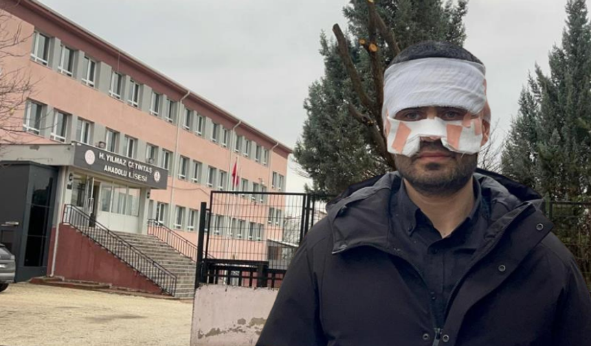 Eskişehir'de yaşanan skandal olayda öğretmenden açıklama geldi: "Sıcak çayı yüzüme fırlattı"