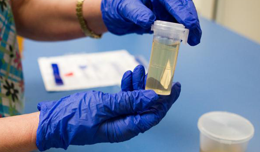 Mehmet Göktekin yazdı:  “Uyuşturucu testi” yaptırdınız mı?