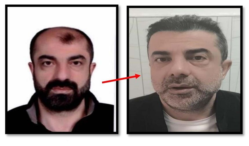 Ameliyat ile yüzünü değiştiren firari cinayet zanlısı, 7 yıl sonra yakalandı